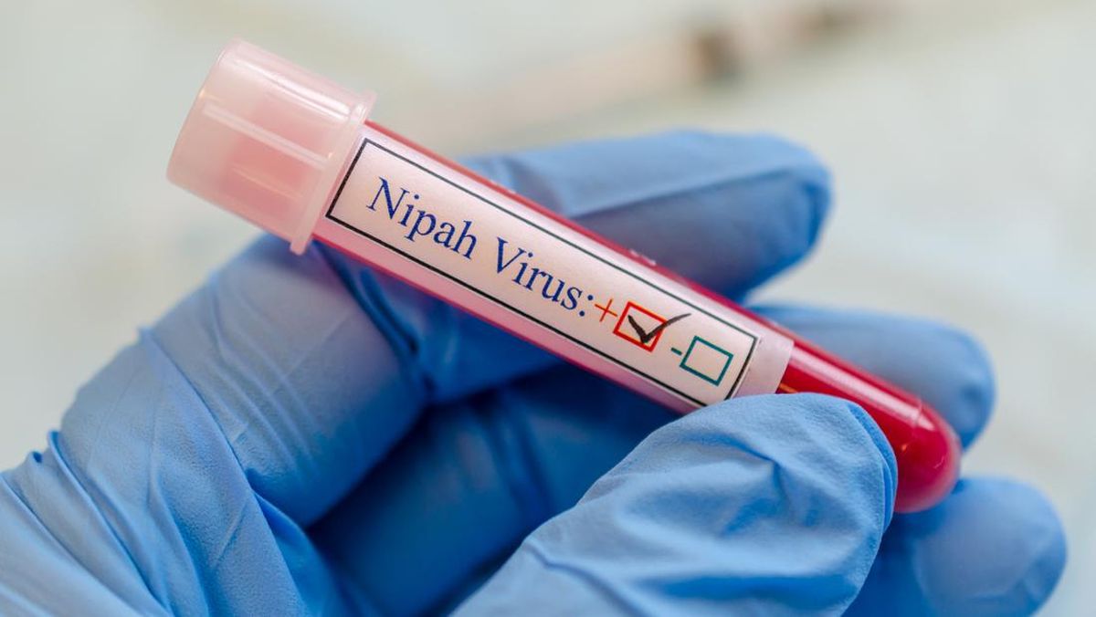 Kasus Meninggal Virus Nipah